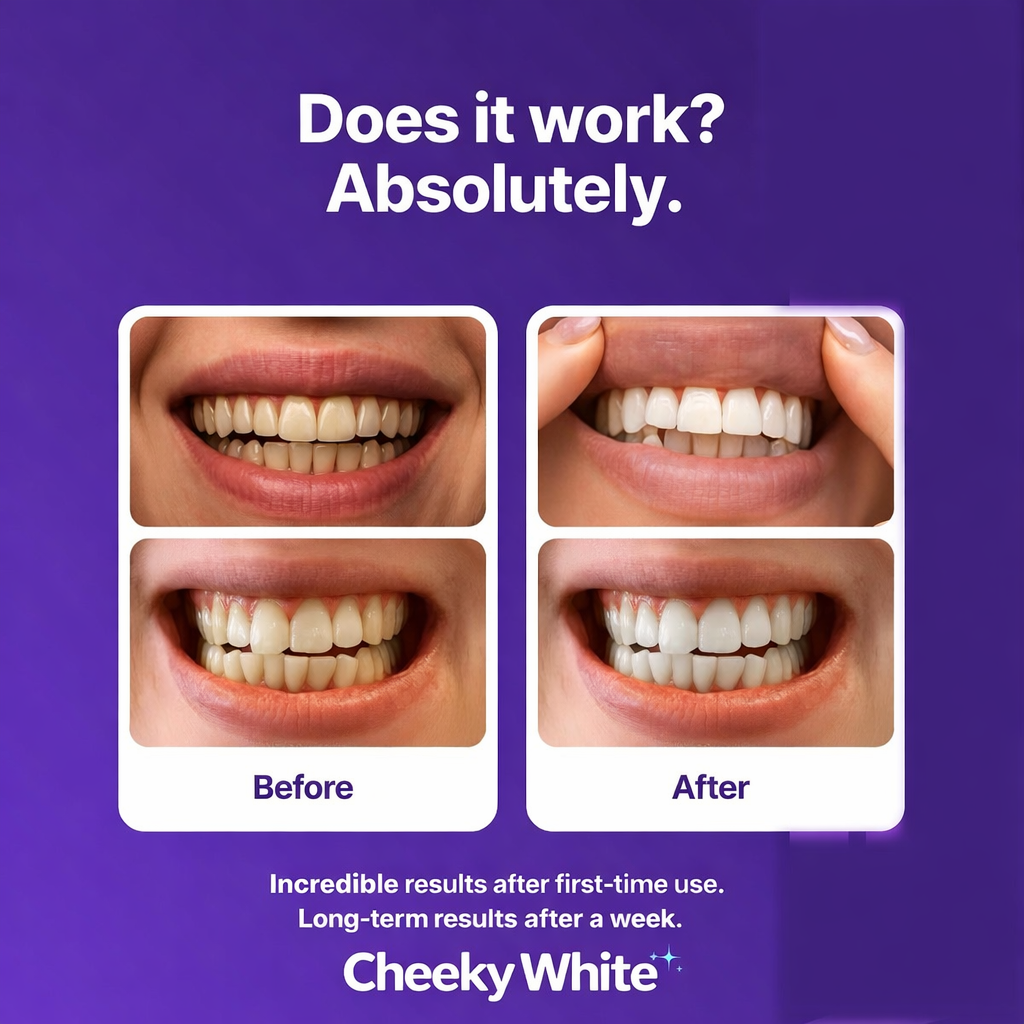 Cheeky White Purple Teeth Whitening Strips